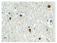 AP06675PU-N - ATF7