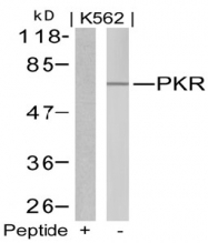 AP02771PU-S - EIF2AK2 / PKR