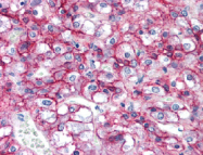 AM05639PU-L - CD56