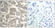 AP08086PU-N - Cofilin-1