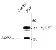 AP31628PU-N - Aquaporin-2 / AQP2