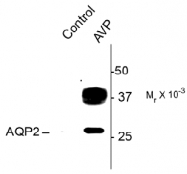 AP31629PU-N - Aquaporin-2 / AQP2