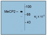 AP31635SU-N - MeCP2