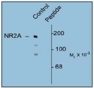 AP31638PU-N - NMDA Receptor 2A