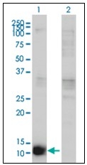 AM31774PU-N - Cystatin-B