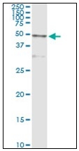 AM31775PU-N - Cathepsin D