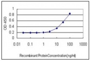 AM31776PU-N - Dihydrolipoyl dehydrogenase