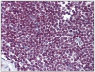 AM31789PU-N - FOXO3 / FKHRL1