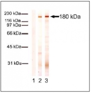 AM02250PU-S - Collagen type XVII alpha 1 chain