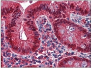 AM31810PU-N - Galectin-4