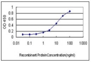 AM31816PU-N - Neuroserpin / SERPINI1