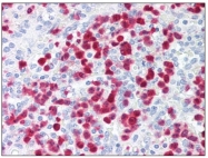 AM31838PU-N - S100A8 / Calgranulin-A / MRP8