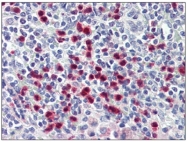 AM31838FC-N - S100A8 / Calgranulin-A / MRP8
