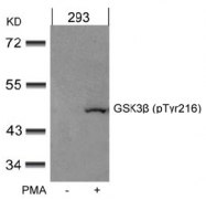 AP02535PU-S - GSK3 beta
