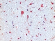 AM21050PU-N - Estrogen receptor beta