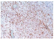 AM10048SU-N - Catenin beta-1