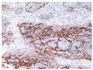 AM10052SU-N - Mucin-16 / CA125