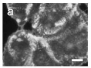 AP02251PU-S - Collagen type XVII alpha 1 chain