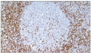 SM1117S - CD45 / LCA