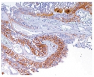 SM1118S - CD44v6