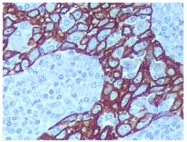SM1359 - Cytokeratin 14