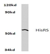 AP06665PU-N - Histidyl-tRNA synthetase / HARS