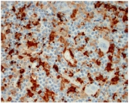 AM10085SU-N - Fascin