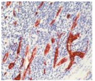 AP10428PU-N - von Willebrand factor (VWF)