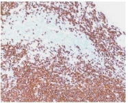 BM4048L - CD20