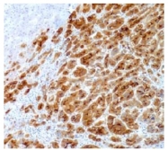 AM10091SU-N - Glypican-3 / GPC3