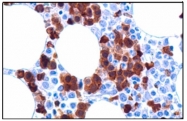 AM10092SU-N - Hemoglobin alpha
