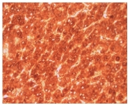 AP10421PU-N - Alpha-fetoprotein / AFP