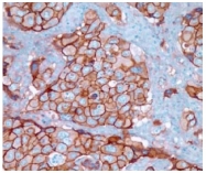 AM10079SU-N - CD324 / Cadherin-1