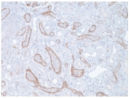 AP10424PU-N - Complement C4d