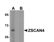 AP31008PU-N - ZSCAN4