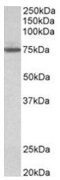 AP31691PU-N - Transglutaminase-4 (TGM4)