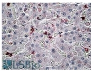 AP31717PU-N - MIP3 alpha / CCL20