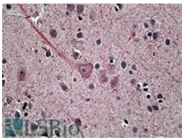 AP16929PU-N - Synaptotagmin-1