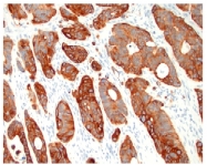 AM10100SU-N - Cytokeratin 20