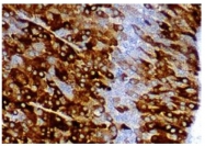 AM10098SU-N - Inhibin alpha / INHA