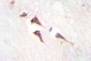 AP06628PU-N - mTOR / FRAP1