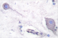 AP06316PU-N - CD172a / SIRPA