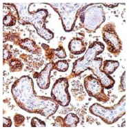AM00486SU-N - Chorionic Gonadotropin (hCG)