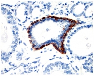AM10102SU-N - Cytokeratin 5+6