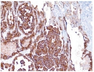 DM057S - Cytokeratin 7