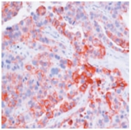 AM10104SU-N - Cytokeratin 8