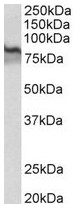 AP31689PU-N - Transglutaminase-2 (TGM2)