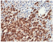 AP10434PU-N - Lysozyme C