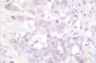 AP06407PU-N - POLR2A