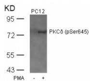 AP02533PU-S - PRKCD